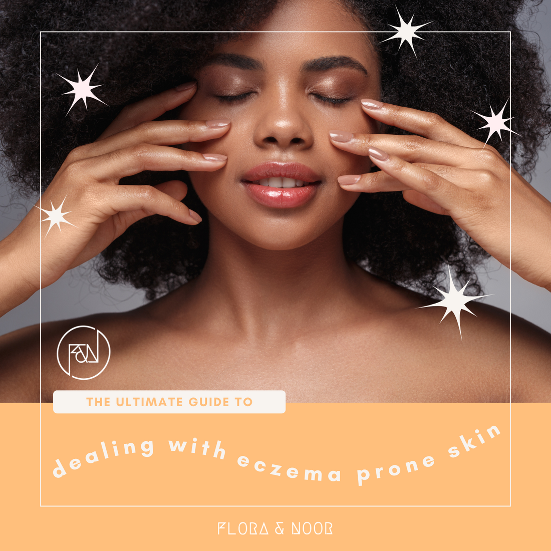 Dealing With Eczema Prone Skin